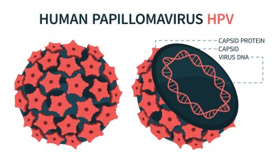 Condyloma and Papilloma Virus - What is the difference?